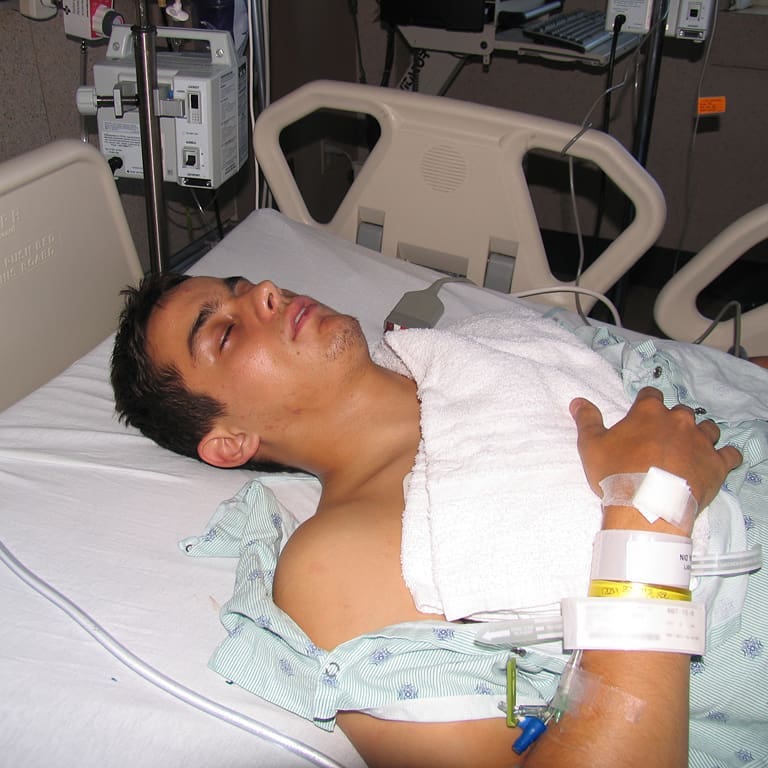 Spinal Cord Injury Motorcycle Crash 2008